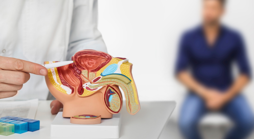 Benign-Prostatic-Hyperplasia-BPH