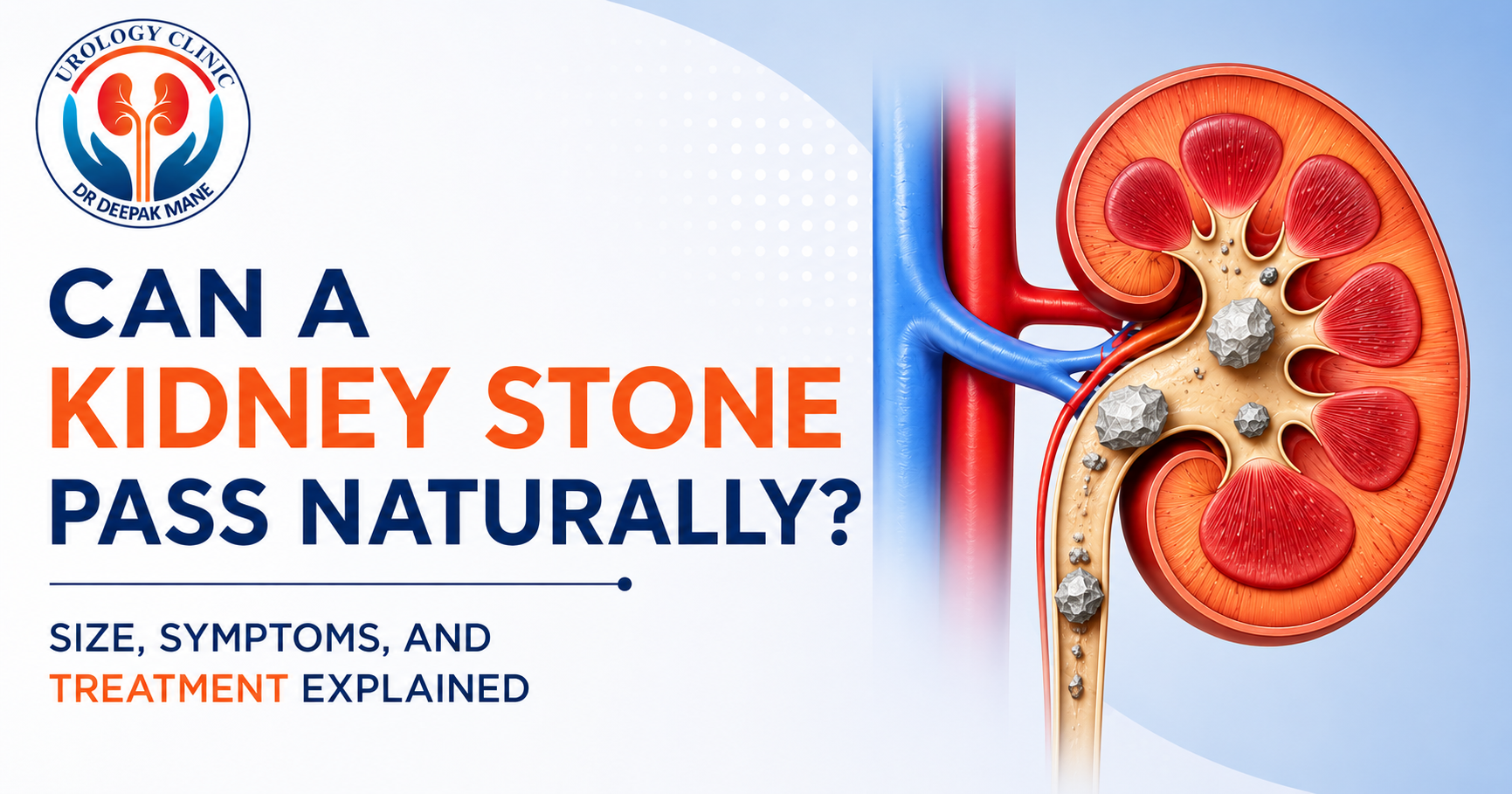 Medical blog banner titled "Can a Kidney Stone Pass Naturally? Size, Symptoms, and Treatment Explained" featuring the Urology Clinic logo and a detailed kidney illustration highlighting kidney stones.